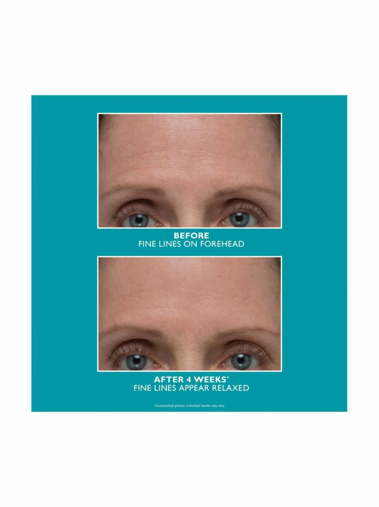 Peptide Skinjection Amplified Wrinkle-Fix Serum -seerumi