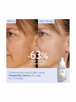 Vinoperfect Brightening Dark Spot Serum&nbsp;-seerumi
